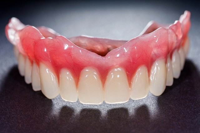 Tipos de prótese dentária e como cuidar