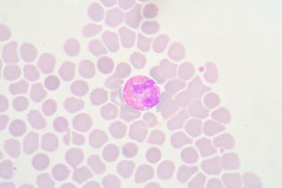 Eosinophile in der Blutprobe