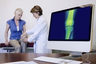 Imagem ilustrativa do artigo Osteomalacia: o que é, sintomas, causas e tratamento