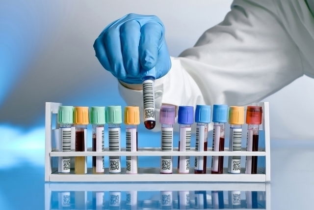 AST/ALT Blood Test: What Is It For and Normal Levels - Tua Saúde