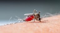 Principais sintomas da dengue (clássica e hemorrágica)