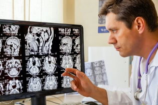 Imagen ilustrativa del artículo Epilepsia: qué es, síntomas, causas, tipos y tratamiento