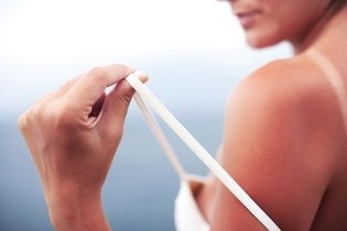 7 truques para evitar mancha de queimadura na pele