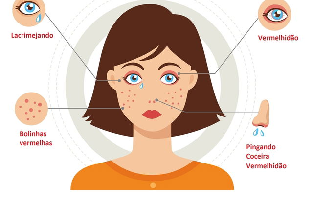 Alergia Ao Pó Sintomas Causas E Medidas De Prevenção Tua Saúde