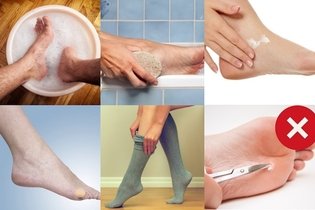 Imagen ilustrativa del artículo Cómo quitar los callos de los pies en 5 pasos