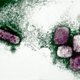 Varíola dos macacos (Monkeypox): o que é, sintomas, tratamento e cura