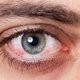  O que fazer em caso de ferimento nos olhos