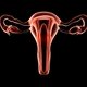 Cauterización del cuello uterino: cómo se realiza y recuperación