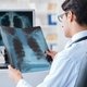 Hipertensão pulmonar: o que é, sintomas, causas e tratamento