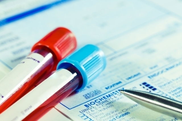 normal bilirubin levels in adults