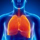 Embolia pulmonar: o que é, sintomas, causas e tratamento