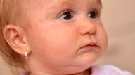 Alergia en la piel en bebés: causas, síntomas y qué hacer 
