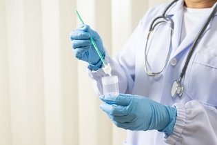 10 exames que detectam o HPV