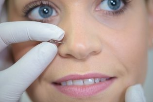 Quelóide no nariz: opções de tratamento e como evitar