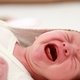 Síndrome do bebê sacudido: o que é, sintomas, tratamento e sequelas