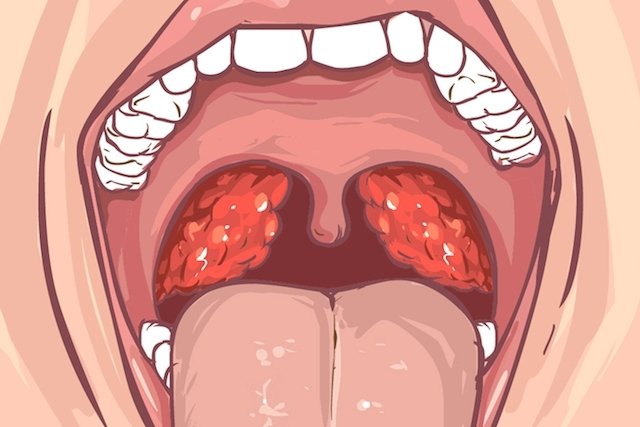 Tienes manchas rojas en la lengua  INARI Estudio Dental
