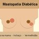 Saiba como tratar a Mastopatia Diabética