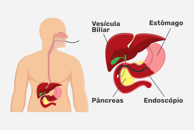 Endoscopia: o que é, como é feito e cuidados necessários