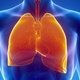 Trombose pulmonar: o que é, sintomas, causas e tratamento