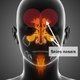 Sinusopatia: o que é, sintomas e tratamento
