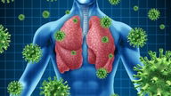 Tratamiento para la infección pulmonar (y complicaciones)