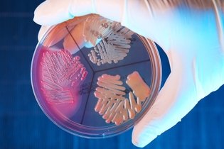 Imagem ilustrativa do artigo 12 doenças causadas por bactérias: sintomas e tratamento