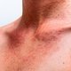 Bumps of Skin: 6 Common Causes & What to Do