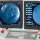 Angiografia: o que é, para que serve e como é feita