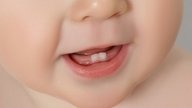 10 Teething Symptoms in Babies: Drooling, Red Gums & More