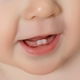 10 Teething Symptoms in Babies: Drooling, Red Gums & More