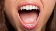 HPV na boca: sintomas, tratamento e formas de transmissão