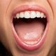 HPV na boca: sintomas, tratamento e formas de transmissão