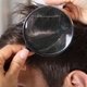 Enfermedades del cuero cabelludo: 6 causas y qué hacer para tratarlas