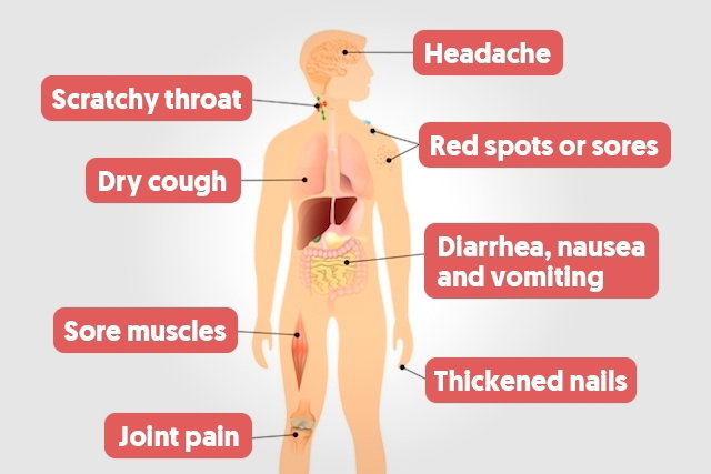 hiv symptoms in throat