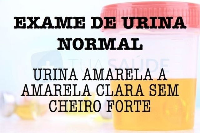 Exame de urina - Para que serve Valores de Referência