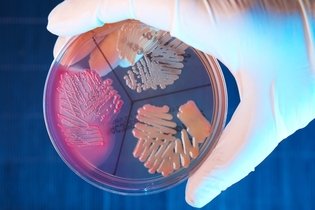 Imagem ilustrativa do artigo Staphylococcus epidermidis: o que é, sintomas e tratamento