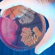 Staphylococcus epidermidis: o que é, sintomas e tratamento