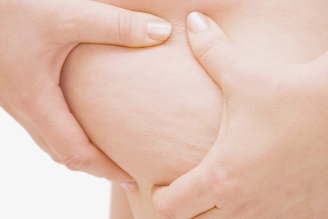 5 علاجات للتخلص من الدهون الموضعية
