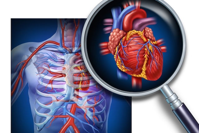 Doen As Cardiovasculares Sintomas Causas E Tratamento Tua Sa De