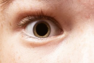 Illustrative image of the article Dilated Pupils: 7 Common Causes & What to Do