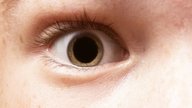Pupilas dilatadas: 7 principales causas y cuándo se considera grave