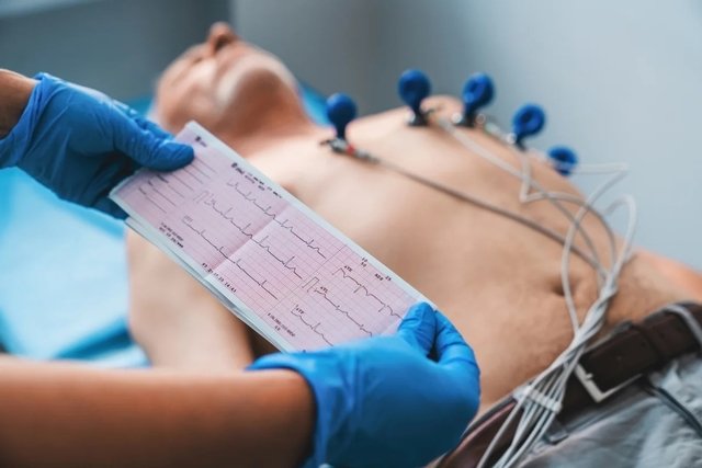 Electrocardiograma (ECG): qué es, cómo leer, para qué sirve