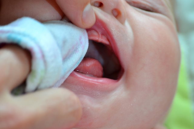 Featured image of post Imagens De Dente Nascendo Na Gengiva - Gengivite, que é a inflamação da gengiva;