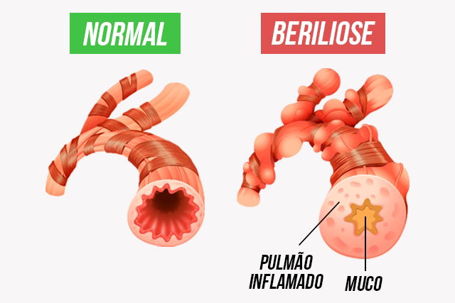 Imagem ilustrativa número 1