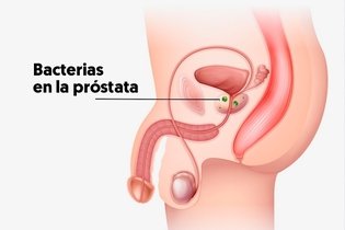 Imagen ilustrativa del artículo Próstata: qué es, función, enfermedades comunes (y otras dudas)