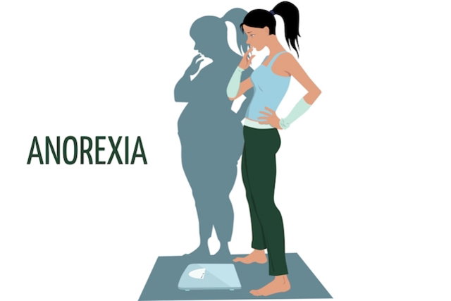 Anorexia X Bulimia Patologia Vs Diagn Stico