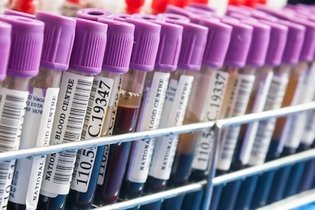 11 exames de sangue que detectam o câncer