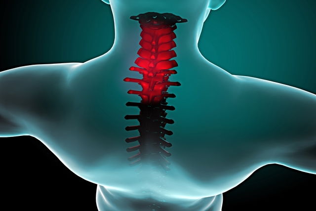 Problemas na coluna vertebral: cuidado com movimentos ao arrumar a