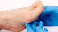 Swollen Feet & Ankles: 10 Common Causes & What to Do