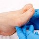10 causas principales de pies y tobillos hinchados y qué hacer 